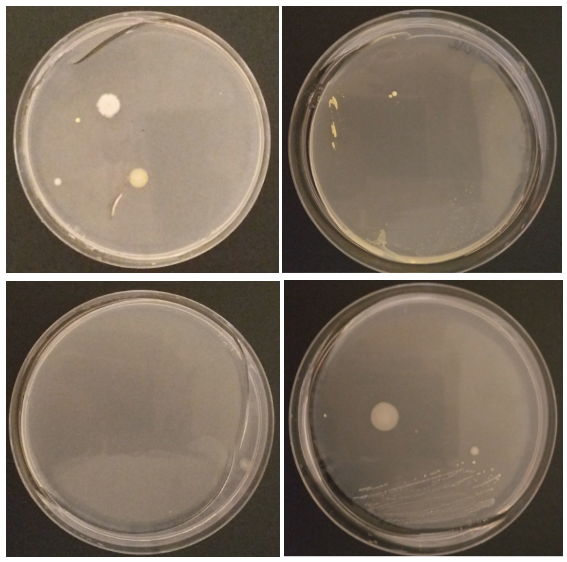 48 hour streak plates (clockwise from upper left): 1. Control, 2. Culterelle, 3. Nature’s Way, 4. Breast Milk