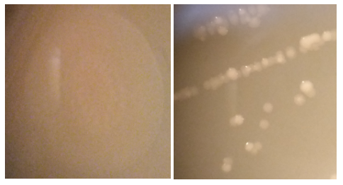 Sample 5 from plate 3: Nature’s Way and sample 6 from plate 4: Breast Milk.